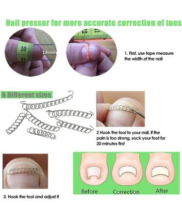 Braleto Toenail Clippers Set Manicure Tools Set for Thick Nails Stainless Steel Toenail Cutters Nail File Ingrown nail pliers Gel Big Toe Cap toenail corrector strips for Ingrown Toenail Treatment - Buy Online on GoSupps.com