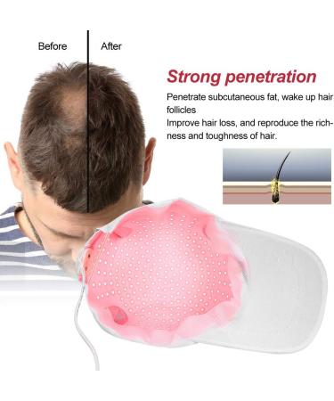 Hair Growth Hat 280pcs Lamp Beads Hair Growth Cap Hair Loss Treatments Helmet for Thinning Hair Hair Regrowth Equipment Oil Control Stimulate Hair Growth System - Buy Online on GoSupps.com