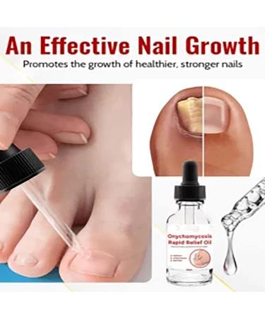 2023 La Nouvelle Huile de soulagement Rapide de l'onychomycose favorise Une Croissance des Ongles Plus Saine et Plus Forte 4pcs - Buy Online on GoSupps.com