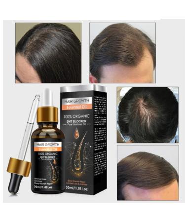 Best Hair Growth Serum | Anti-Hair Loss Solution for Men & Women | Biotin & Vitamins for Damaged Hair - Buy Online on GoSupps.com