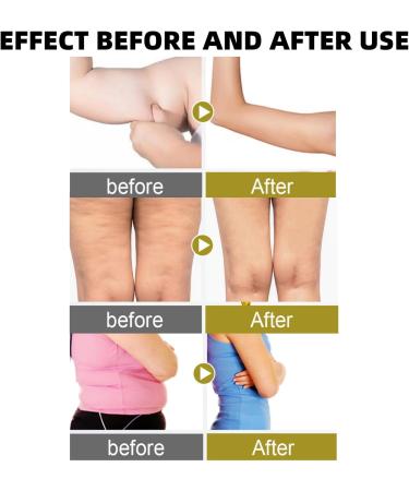 Collagen Fibrillar Oil Firming Body Oil Compact Body Oil Body Oil for Women Skin Lifting Body Oil Skin Firming Body Cream Beauty Women Collagen Lifting Body Oil Collagen Body Lotion Body Treatment Oil - Buy Online on GoSupps.com