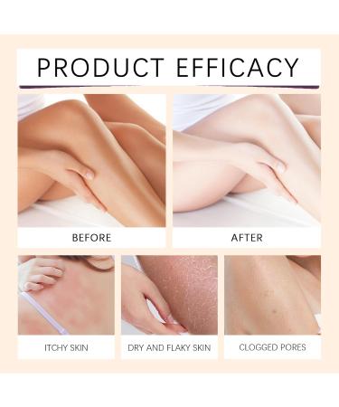 VKaoess Castor Oil Roll on for Tummy Face Body Organic Cold Pressed Castor Oil with Roller Ball Skin Moisturizing Oil for Dry Skin Suitable for Body Soothing Roll 2 Bottles - Buy Online on GoSupps.com