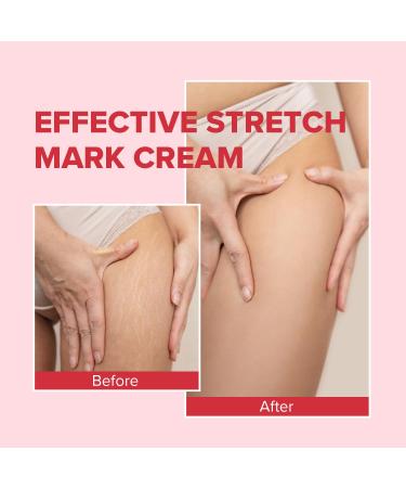 Enaskin Naturals Belly Firming Cream - Skin Tightening Hibiscus & Honey Lotion for Thighs & Stomach - 100ML Anti-Cellulite Tummy Butter for Women - Buy Online on GoSupps.com