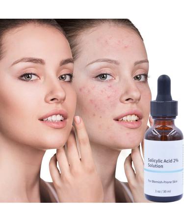 Luxsea Salicylic Acid 2% Serum for Clearer Skin - Shrinks Pores, Treats Rosacea, Blackheads, and Acne - Gentle Exfoliating Hyaluronic Acid Formula - Buy Online on GoSupps.com
