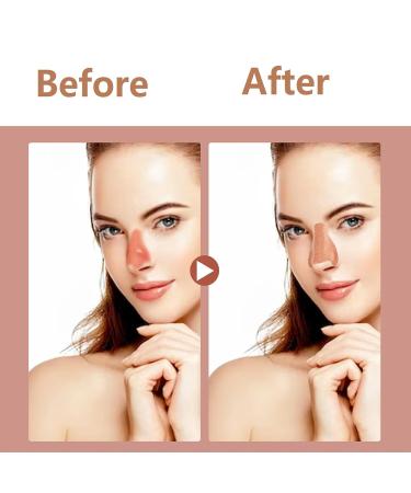 Nasal Sun Protection Plasters - UV Nose Protection for Outdoor Sports (24 Pieces) | Beige Sun Protection Nose Patches - Buy Online on GoSupps.com