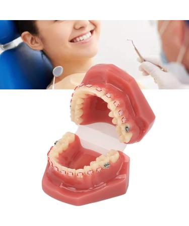 Orthodontic Bracket Model - Educational Demonstration with Metal Wires for Clear Orthodontic Process Representation | International Shipping - Buy Online on GoSupps.com