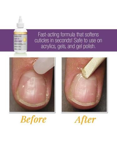 ProLinc Cuticle Eliminator - 4 fl oz - Buy Online on GoSupps.com