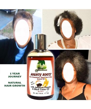 Fountain Mighty Roots - Hair Growth Remedy | Boar Brush Satin Cap & Spray Bottle | Stimulate Follicles for Healthier Hair - Buy Online on GoSupps.com