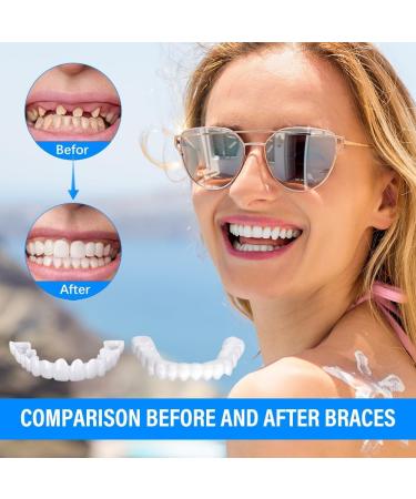 Flipped Warm Dentures | 2 Pairs of Plug-In Veneers for Top & Bottom | Artificial Teeth for Men & Women | Lightweight Braces & Cosmetic Solutions - Buy Online on GoSupps.com