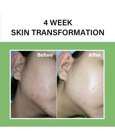 Celimax Noni Energy Ampoule - 71.77% Noni Fruit Extract, 30ml - Korean Skin Care for Anti-Aging & Anti-Wrinkle - Buy Online on GoSupps.com