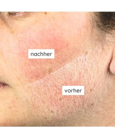 Mylily Metallic Black Eyebrow Razor for Women | Facial & Dermaplaning Razor | Precision Eyebrow Knife for Smooth Skin - Buy Online on GoSupps.com