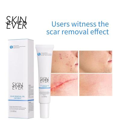 Herbal Gel Ointment Removal Pads 30g - Gentle Scar Soothing Facial Care - Personal Skin Care - Buy Online on GoSupps.com