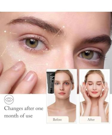 Berber Eye Cream Instantly Firming Berber Eye Cream Cream for Puffy Eye Bags and Under Eye Bags. (1sticks * berbax eye cream) - Buy Online on GoSupps.com