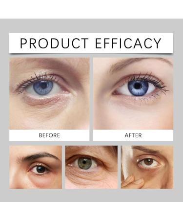 EyeCream for Eye Bags 2025 New Turmeric Cream Erases Eye Bags Within Minutes Moisturizing Under Eyes Balm for Travel Eyes Care Serum for Women (2pcs) - Buy Online on GoSupps.com