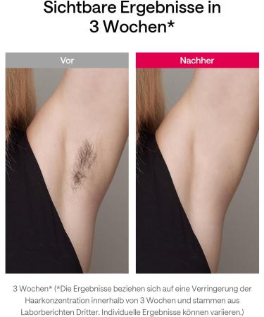 Ulike Air 3 IPL Hair Removal Device - Sapphire Ice Cooling for Painless Long-lasting Results | At-Home Laser Hair Removal for Men & Women - Pink - Buy Online on GoSupps.com