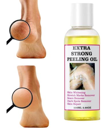Generic Yellow Peeling Oil Lightening Exfolia_ting Dark Skin Skin Peeling Oil For Skin Lightening 110ml Effective Gentle Body Exfoliate Peeling Oil Peeling Oil Extra Strength Whitening - Buy Online on GoSupps.com