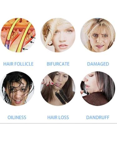 Skin Diagnosis Hair Analyzer 10.1inch Screen Multi Functional High Definition Rechargeable Skin Scalp Hair Follicle Detector High Sensitivity Digital Hair Follicle Skin Analyser Machine - Buy Online on GoSupps.com