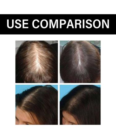 SHENGZE Identicalven Hair Loss ShampooGinger Plant Extract AntiHair Loss Hair ShampooAnti Hair Loss ShampooHair Growth Plant ShampooOil Control AntiDandruff Shampoo for Women Menfor All Hair Types - Buy Online on GoSupps.com