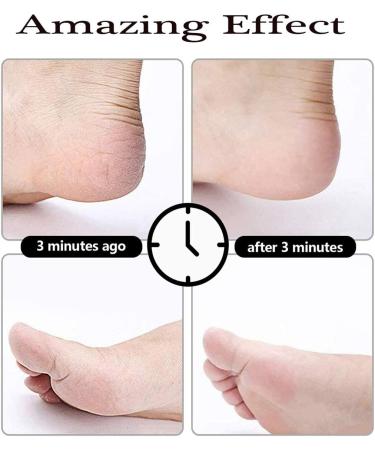 Founded Set 20 in 1 Pedicure Set - Professional Stainless Steel Foot Care Kit for Men & Women | At-Home or Salon Use - Buy Online on GoSupps.com