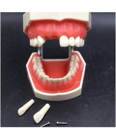 Vinbcorw Dental Care Model - 24 Removable Teeth for Adult Teaching (12x9.5 cm) - Ideal for Dentists & Educators - Buy Online on GoSupps.com