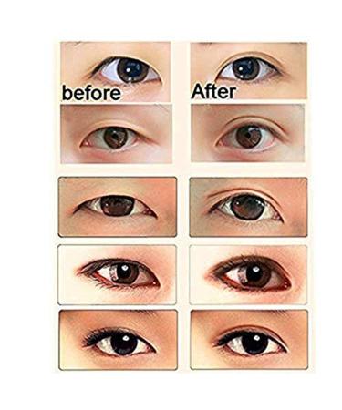 Non-Sticky Lace Eyelid Tape - Breathable Double Eyelid Strips for Hooded Eyes | Instant Invisible Eyelid Lift (Pink B) - International Shipping Available - Buy Online on GoSupps.com