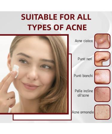 LAKPYN AntiPimple Cream 35 g Fights Pimples And Impurities Effective Acne Cream For Clear And Healthy Skin Suitable For All Skin Types - Buy Online on GoSupps.com