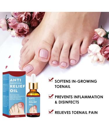 Ingrown Toenail Treatment Ingrown Toenail Treatment Drop Toenail Anti Paronychia Relief Oil Fungal Nail Treatment for Toenails Ingrown Toenail Treatment Nail Growth Treatment Nail Care (30ML) - Buy Online on GoSupps.com