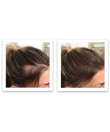 FEBRON Spray Applicator Pump - Easy and Precise Hair Extension Application - Buy Online on GoSupps.com