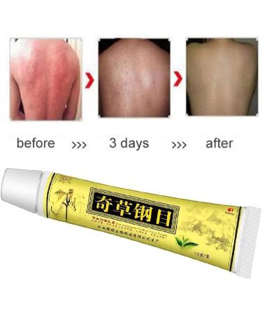 Visalift Natural Chinese Herbal Eczema Psoriasis Creams - 5PCS - Buy Online on GoSupps.com