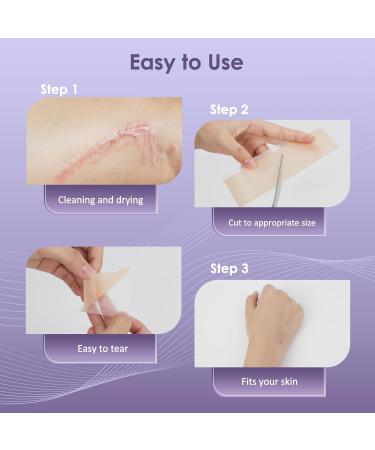 Skiennix Silicone Scar Sheets 1.6 x 120 Roll-3M | Medical Grade Reusable Scar Tape for Surgical Scars, Keloids, C-Sections | Painless Scar Treatment - Buy Online on GoSupps.com