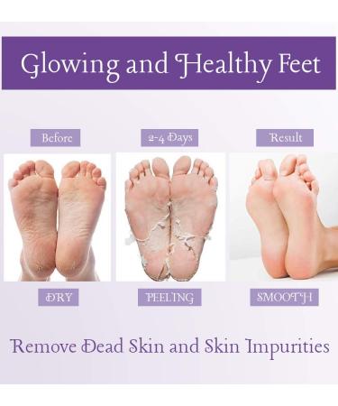 Foot Peel Mask 2-Pack - Exfoliates Calluses & Cracked Heels - Lavender Scent - Softens Dry Skin - Men and Women - Buy Online on GoSupps.com
