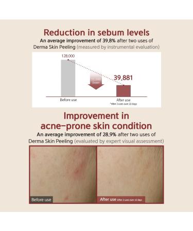  BQCELL Made In Korea DERMA SKIN PEELING 2g / Recell Cure Serum 2ml Safety Cap 1ea 3set Acne Skin Available Exfoliating Facial Scrub Korean Beauty Blackhead Remover - Buy Online on GoSupps.com