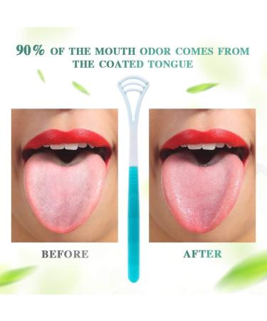 Ghzzy Tongue Scraper - 6 Pack Soft Antibacterial Tongue Cleaners for Fresh Breath | Inhibit Bad Breath & Promote Oral Hygiene - Buy Online on GoSupps.com