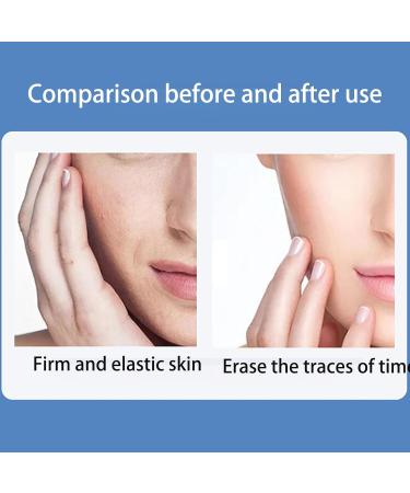 VolksRose Face & Chest Wrinkle Patches Reusable Silicone Patches for Brow Lift Wrinkle Smoothers Cleavage - Overnight Anti-wrinkle Face Tape Mask Smoothing Pads for Anti-wrinkles 3 Patches incl T-Shaped Decollete Pad - Buy Online on GoSupps.com