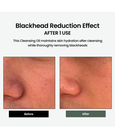 delphyr Liposome Daily Cleansing Oil Gentle Makeup & Blackhead Remover for Sensitive Skin with Centella Asiatica TECA Korean Skincare for Trouble Care (6.76 fl. oz. 200ml) - Buy Online on GoSupps.com