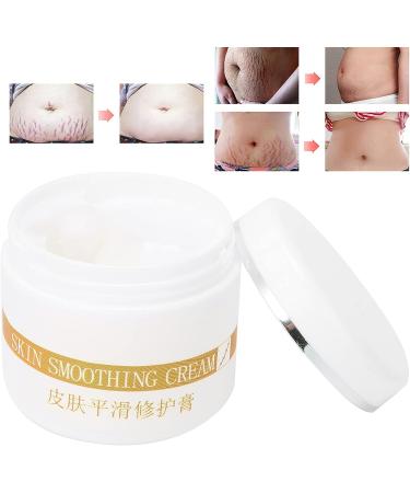 Scar Repair Cream 30G - Stretch Marks & Burn Marks Removal Ointment - Buy Online on GoSupps.com