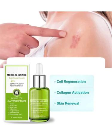 Advanced Scar Repair Serum - Medical Grade Treatment for All Types of Scars - 3PCS Set - Buy Online on GoSupps.com