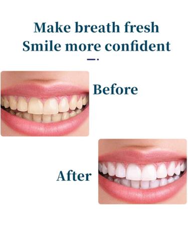 Yayashi Sp-4 Toothpaste Yiliku sp-4 Toothpaste SP-4 Brightening Toothpaste Fresh Breath Toothpaste (Blue*2) - Buy Online on GoSupps.com