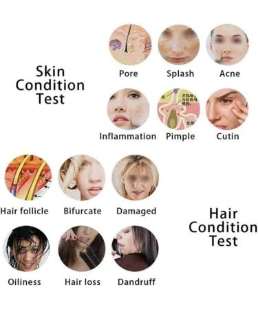 Skin Diagnosis Hair Analyzer 5 Inch LCD Screen Digital Skin Detector Moisture Tester Hair Skin Analyzer Machine 50X 200X Skin Scalp Detector for Analysis Scalp Home Salon Spa - Buy Online on GoSupps.com