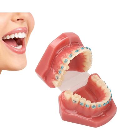 Typodont Orthodontic Tooth Model (28 Teeth) - Realistic Crowded Teeth & Malocclusion Representation for Dental Education & Practice - Buy Online on GoSupps.com