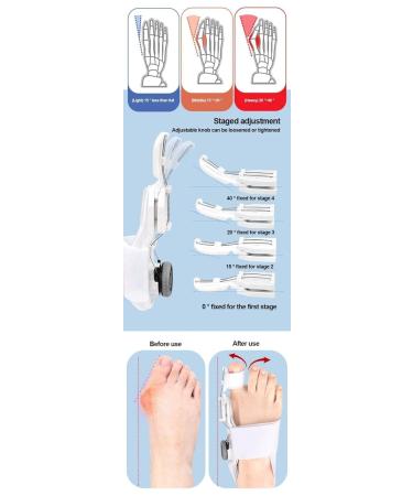 Adjustable Bunion Corrector for Men & Women - Orthopedic Toe Straightener with Non-Slip Heel Strap & Silicone Pad - Grey - Buy Online on GoSupps.com