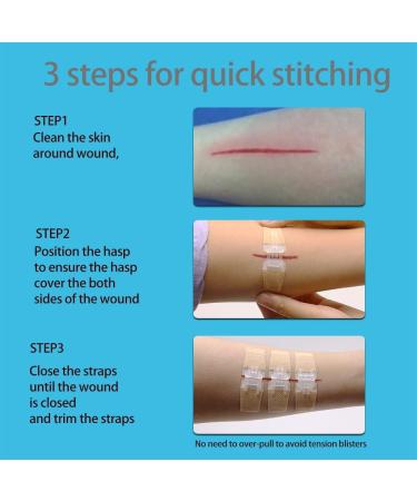 Longmed Emergency Wound Closures - Butterfly Adhesive Bandages - 3 Pieces - Buy Online on GoSupps.com