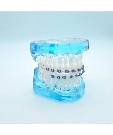 1 Pair of Temporary Tooth Decoration Teeth Retainer Practical Brackets para Dientes Sturdy Retenedores de Dientes Ortodoncia Props for Dental Students to Practice (Blue) - Buy Online on GoSupps.com