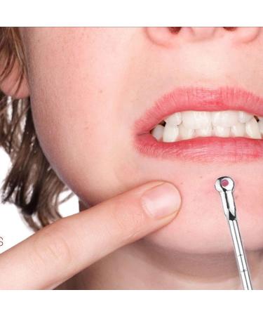 PiurUf Acne Needle Set - 4Pcs Stainless Steel Pimple Remover Tool for Effective Face Care - Ship Internationally - Buy Online on GoSupps.com