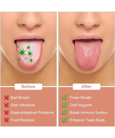 Acwoo Stainless Steel Tongue Cleaner Set - 2 Pieces for Effective Oral Care | Bad Breath Solution | Durable Tongue Scrapers for Adults - Buy Online on GoSupps.com