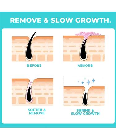 Skinetic Peach Fuzz Hair Removal Cream - Upper Lip Hair Removal Cream for Women Gentle & Soothing Hair Removal for Face Body Facial Mustache Lip Hair Fine Hair (2-PCS) - Buy Online on GoSupps.com