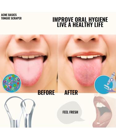 Buy Tongue Scrapers 4 Pack - Stainless Steel Reusable Tongue Cleaners for Bad Breath & Oral Care | Adults & Kids - Buy Online on GoSupps.com