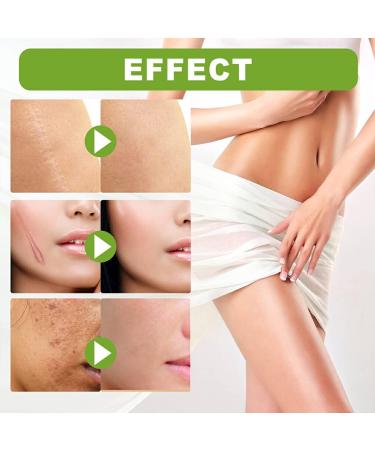 BOKIOESDE Women Hip Chest Stretch Mark Serum Body Burn Scars Serum Girls Skin Care Repair Essence Beauty Supplies - Buy Online on GoSupps.com