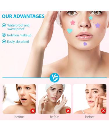 JYNXOR Pimple Patch Star patches pimples stars invisible natural hydrocolloid pimples with tea tree oil salicylic acid acne patch day and night - Buy Online on GoSupps.com