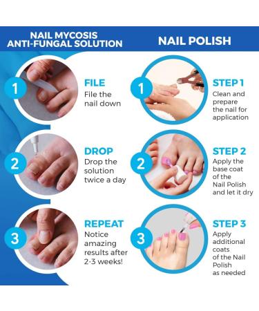 Ultimate Nail Fungus Treatment Set - Fungal nail treatment with Preventive Anti-fungal Shoe and sock Spray and pink Nail Polish - Buy Online on GoSupps.com